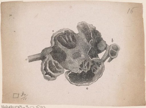 Part of the Human Body with a Deformity