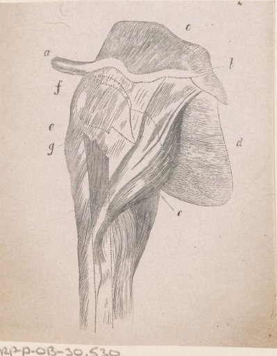 Part of the Human Body with a Deformity