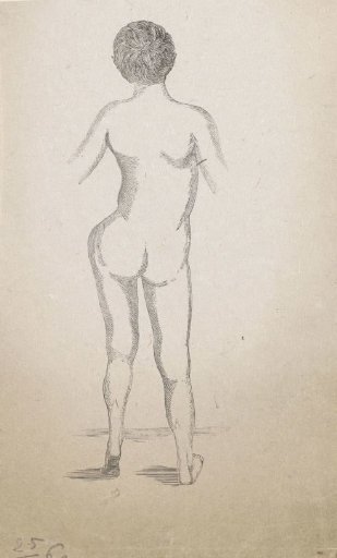 Man with a deformity of the pelvis