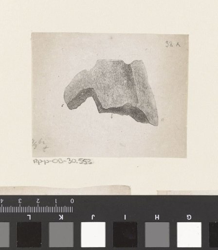 Part of the human body with a deformity