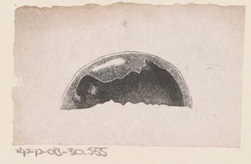 Human skull with a deformity