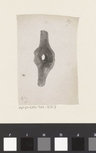 Part of the human body with a deformity