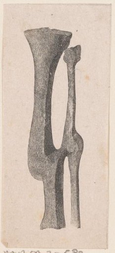 Human bone with a deformity