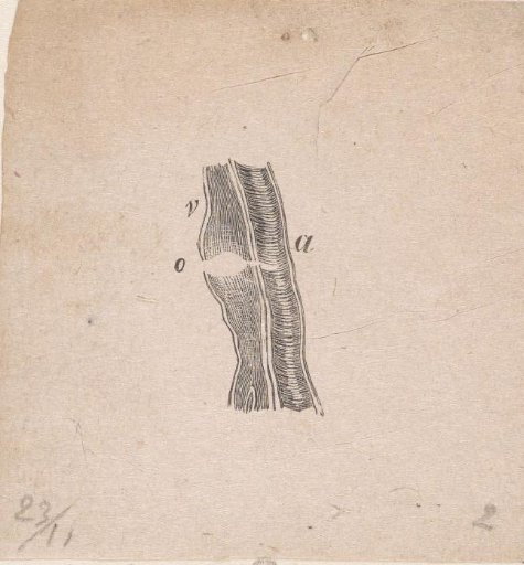 Part of the human body with a deformity