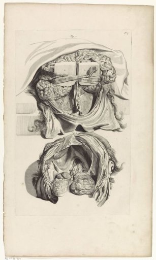 Anatomical Study of the Inside of a Skull