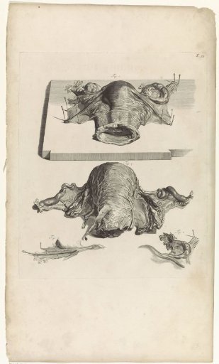Anatomical study of the uterus and the ovaries
