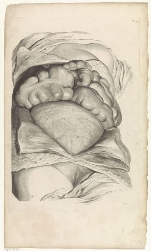 Anatomical study of the intestines and the abdomen of a pregnant woman