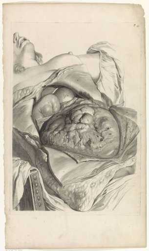 Anatomical study of the outside of the uterus of a pregnant woman