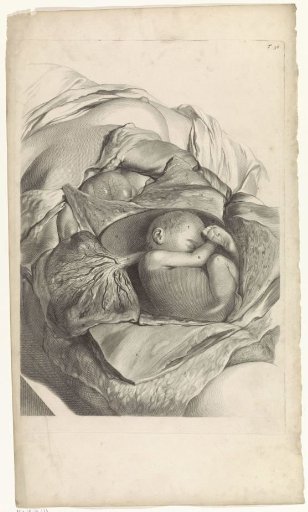 Anatomical study of the inside of the uterus and a fetus