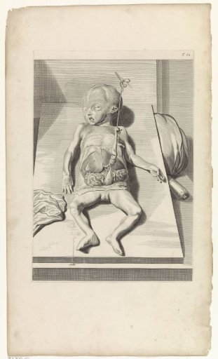 Anatomical study of a fetus