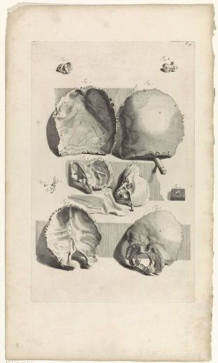 Anatomical study of the back of a skull