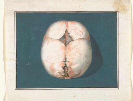Top view of a child's skull (unfused)