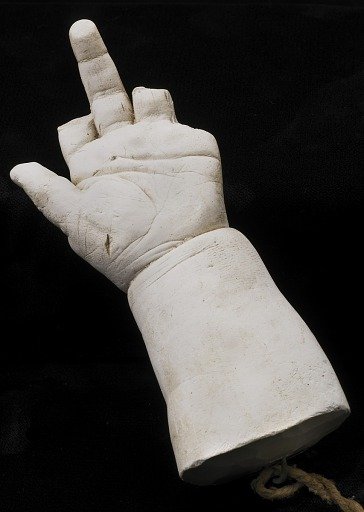 Cast of an Unidentified Baby's Left Hand and Forearm (first and little fingers missing)