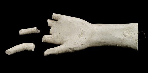 Cast of an Unidentified Child's Left Hand (two fingers partially missing)