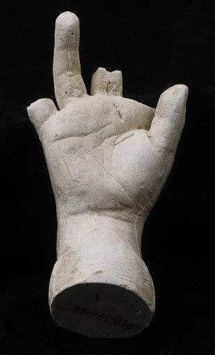 Cast of an Unidentified Child's Right Hand (first, second and little fingers missing)