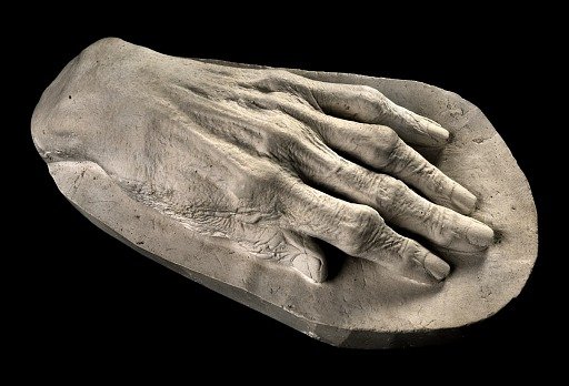 Cast of the Hand of Louisa G. Powers Ibbotson