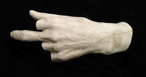 Cast of Unidentified Man's Left Hand (three fingers missing)
