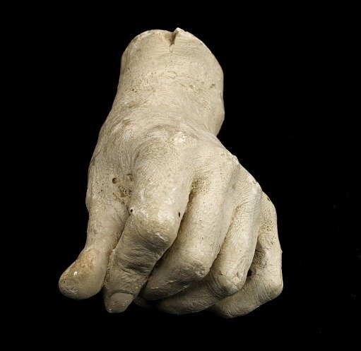 Cast of an Unidentified Man's Left Hand with Fingers Bent