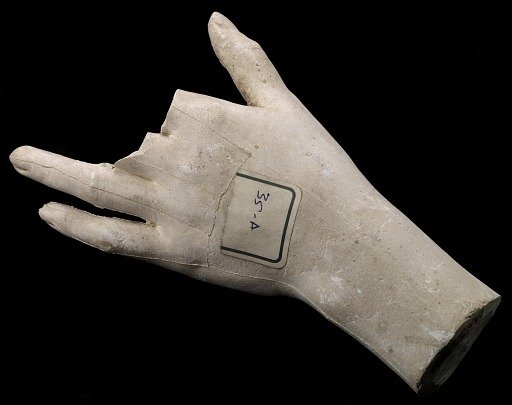 Cast of an Unidentified Woman's Left Hand (two fingers missing)