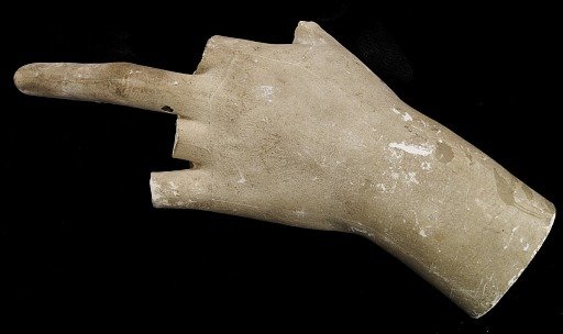Cast of an Unidentified Woman's Left Hand (all but middle finger missing)