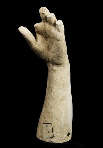 Cast of an Unidentified Woman's Left Hand and Forearm (all fingers missing but thumb)