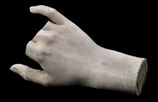 Cast of an Unidentified Woman's Right Hand (three fingers missing)