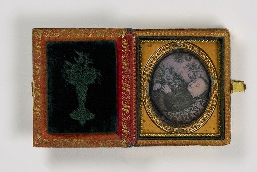 Untitled (Post-mortem of Child)