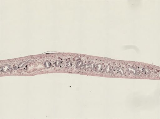 Turbellaria