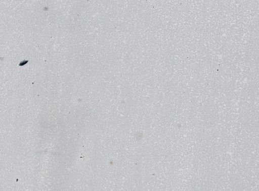 Plasmodium vivax