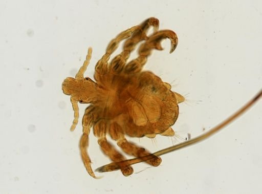 Pthirus pubis