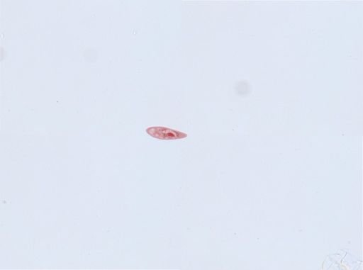 Paramecium aurelia
