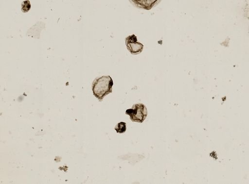 Noctiluca