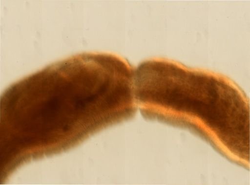 Pontobdella