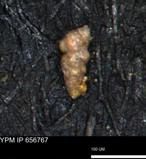 Verneuilina canadensis
