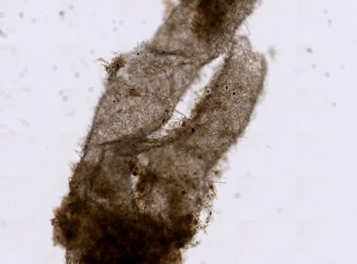 Leucosolenia botryoides