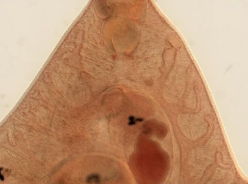 Fasciola hepatica