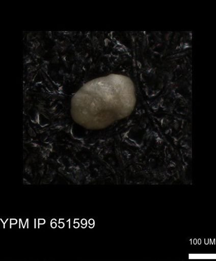 undet. Foraminiferida
