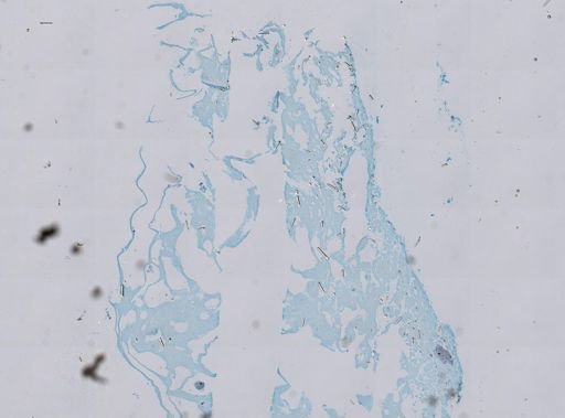 Hispidopetra miniana