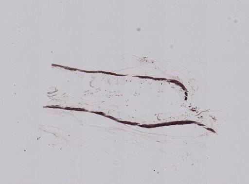 Vampyroteuthis infernalis