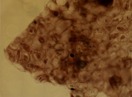 Alcyonidium