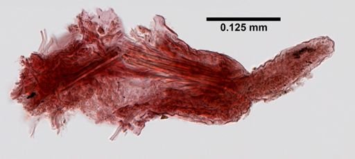 Scoletoma tenuis