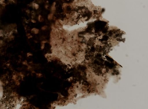 Porifera?