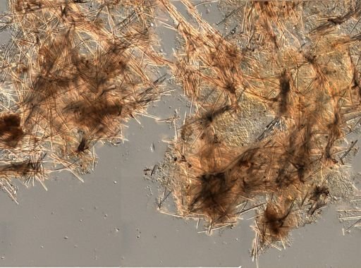 Halichondria sp.