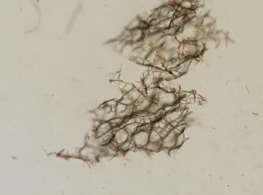 Callyspongia (Cladochalina)