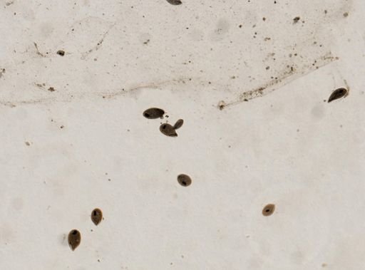 Balantidium