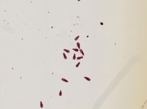 Fasciola hepatica