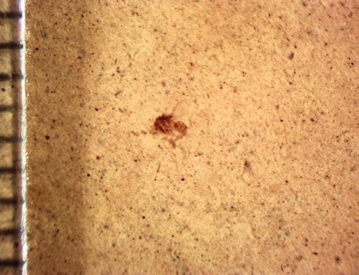 Staphylinidae?