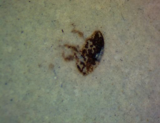 undet. Hexapoda
