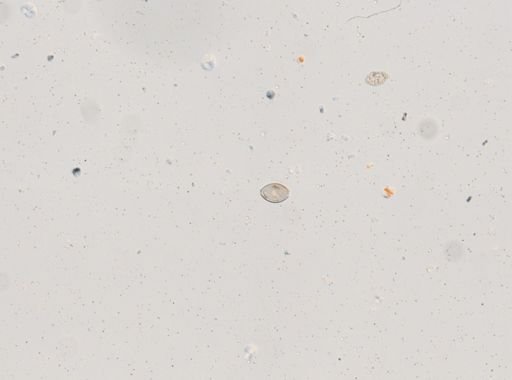 Trichuris vulpis