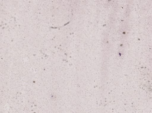Trypanosoma brucei